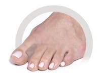 Podopro Toe Spreaders