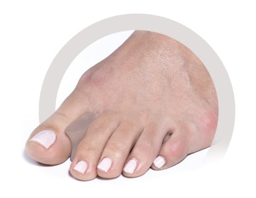 Podopro Toe Spreaders